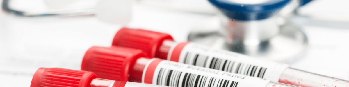 El Paso STD Lab Test